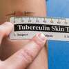  TB Test Made Easy: Free Mantoux Ruler for Accurate Skin Testing!